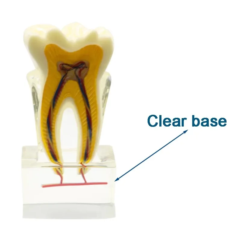 Dental Materials Dental Teeth Nerve Anatomical Dissection Demonstration Model Tool Dentist Endodontic Teaching Orthodontic Model