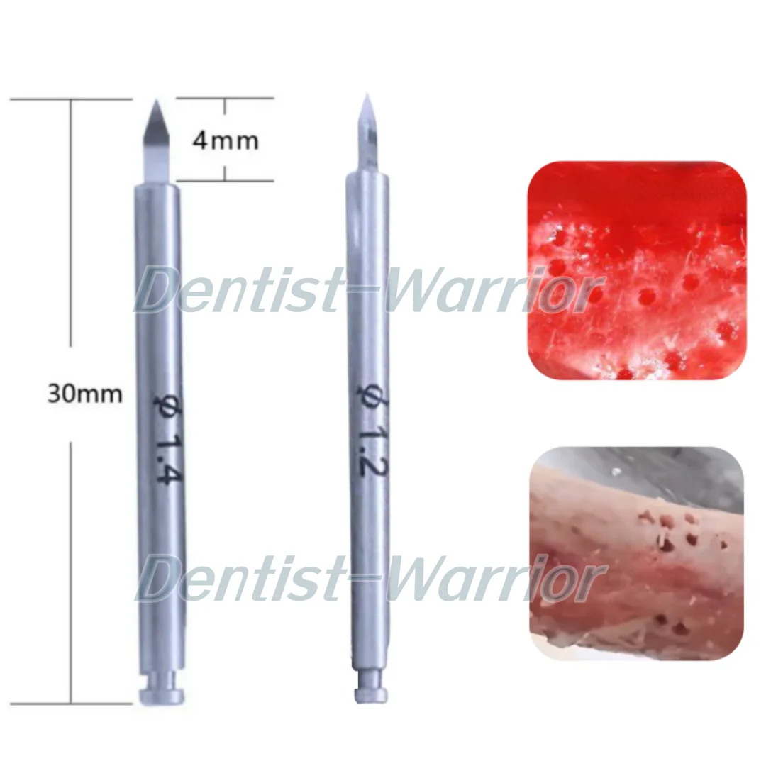 Dental Nutrient Implant Nourishing Drill Bone Increment Nutrient Hole Drill Promote Bone Formation ∅1.2mm/1.4mm