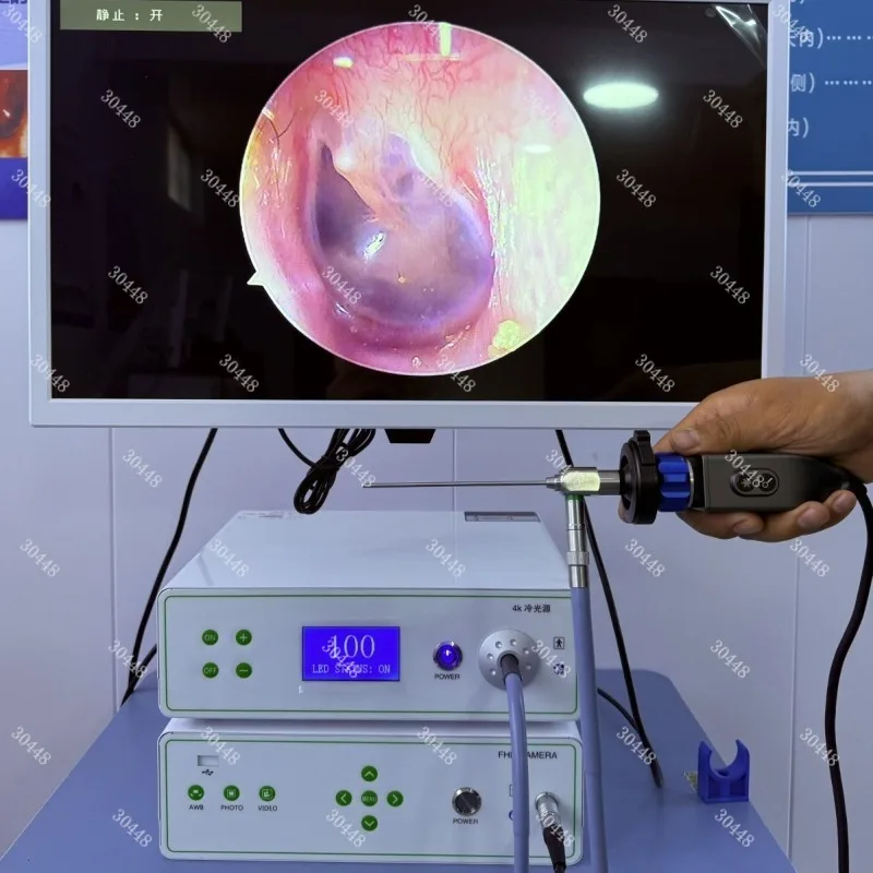 

Двухъядерное визуальное устройство для чистки ушей Ultra HD ЛОР-эндоскоп для записи фотографий и видео