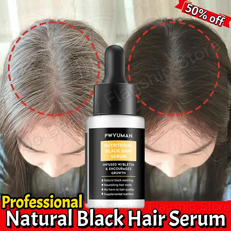 

Anti Gray Hair Essence Hair Blackening Serum White Hair Treatment White To Black Hair Repair Care Nourish Scalp Anti Hair Loss