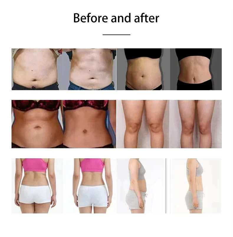 

Портативный аппарат EMSnova 2-в-1 для коррекции фигуры, стимуляции мышц, сжигания жира и снижения веса, неинвазивное косметологическое оборудование для домашнего использования