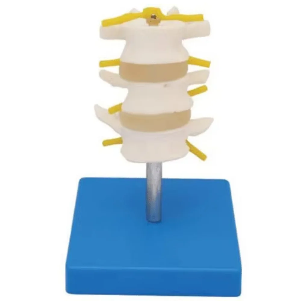 Normal 3-Segment Lumbar Vertebrae Anatomy Model Medical Science NLVM-2/3 Lumbar Spine Anatomical Simulator for Teaching Use
