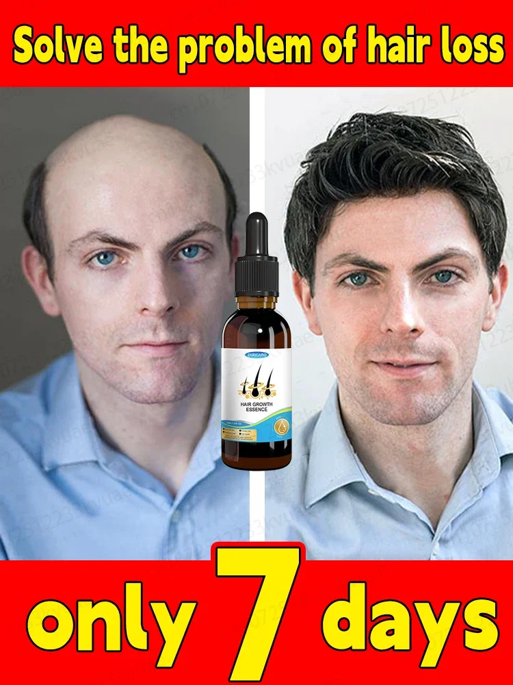 

Essential oil for rapid hair growth that effectively treats baldness and hair loss