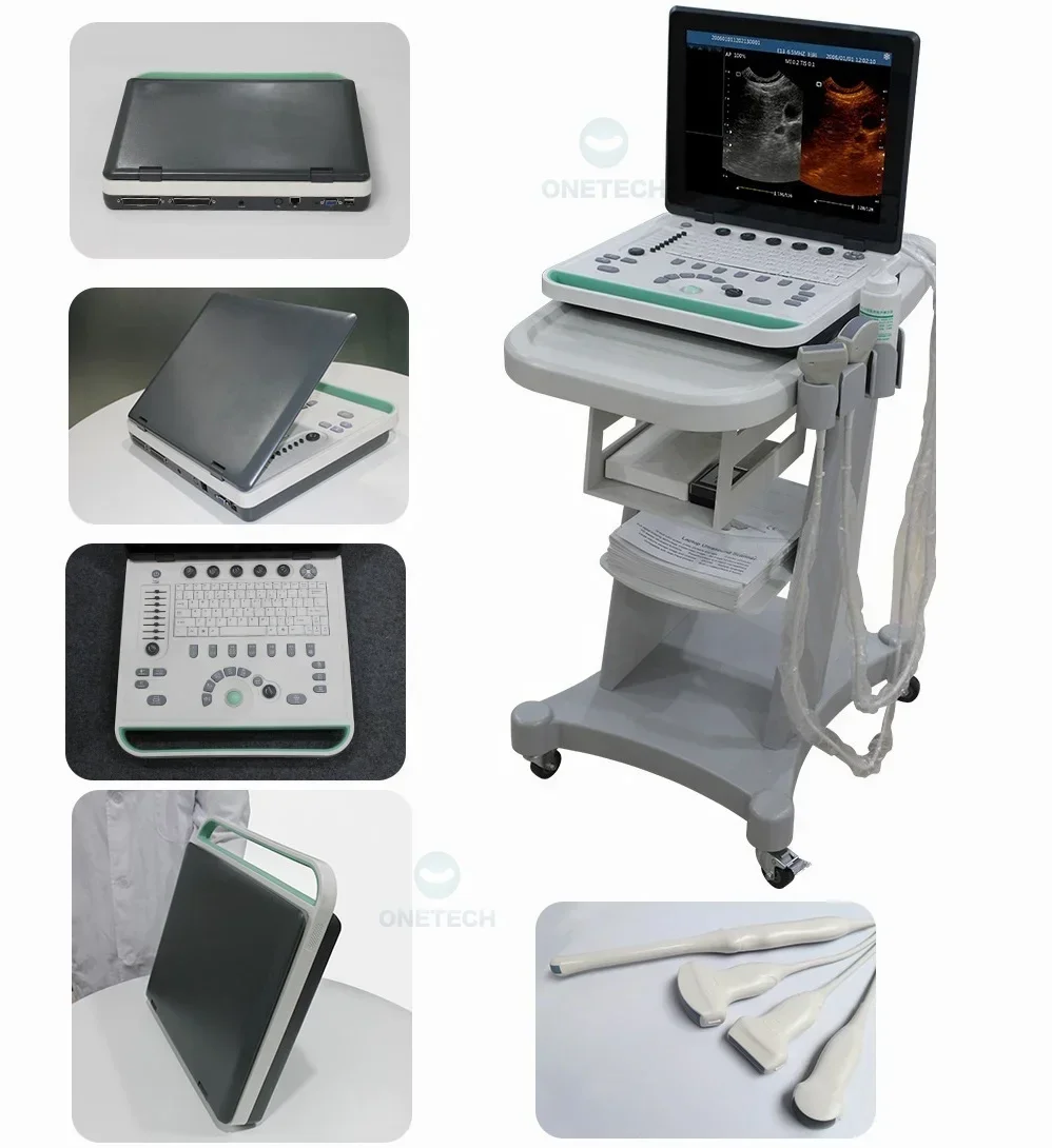 B22VET Intelligent Animal Veterinary Ultrasound Portable /clinic Ultrasound Scanner Price for Scan