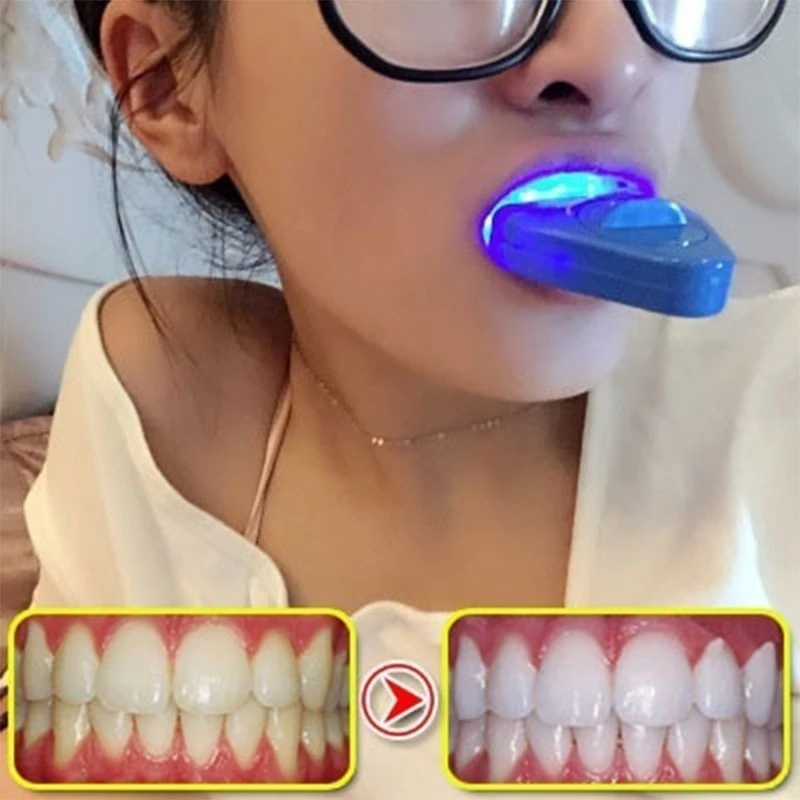 ไฟฟอกสีฟัน LED แสงสีฟ้า แสงยูว - Teeth Whitening Uv Kit บทวิจารณ์และราคา
