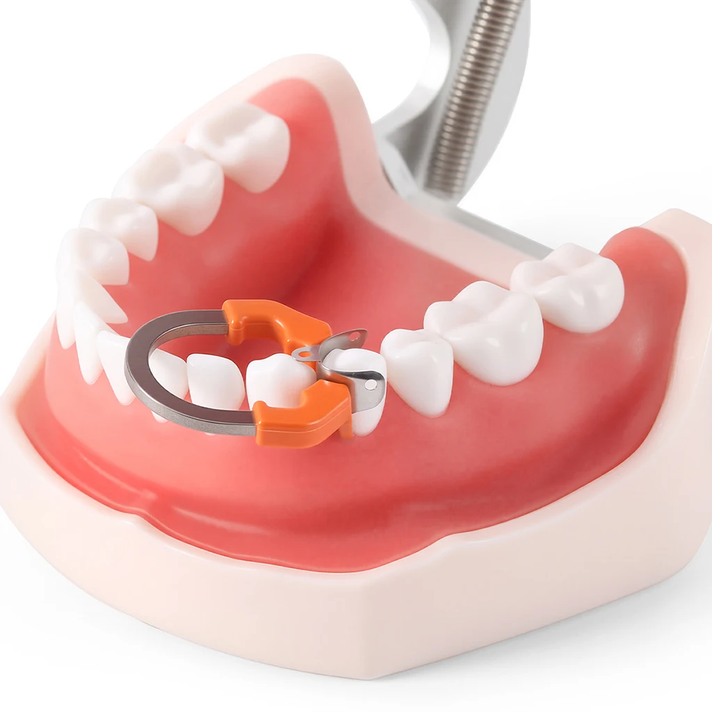 AZDENT Dental-Sektionalmatrizensystem, konturierte 50-teilige Matrizenbänder, M4-Klemmring, R7 Nickel-Titan, D3-Set, Zahnmedizinisches Material – Detail 5