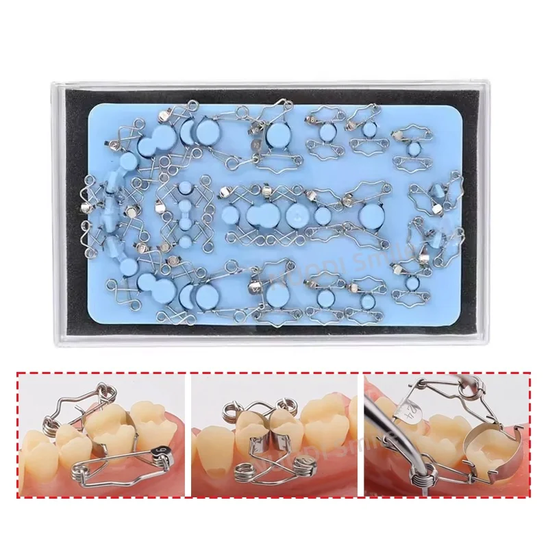 

1 комплект, комплект для формования стоматологической матрицы, стоматологические автоматические матричные ленты, кольцевые секционные контурные матрицы с зажимом-держателем, зажимы, щипцы