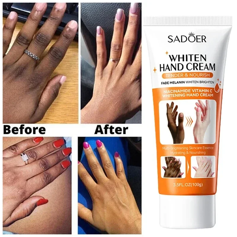 Dark Knuckles Fast Whitening Serum Anti Cracking Cream Pigmentation Correctors For Intense Stains Fast Stains Remover Products