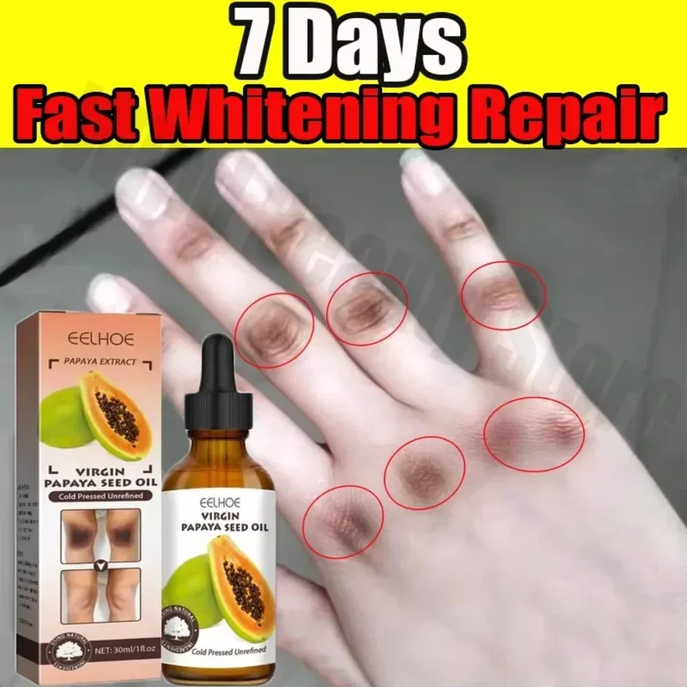 

New Dark Knuckles Fast Brighten Serum Elbows Hand Knuckle Brightening Serum Knee Black Skin Spot Lighten Stains Remover Essence