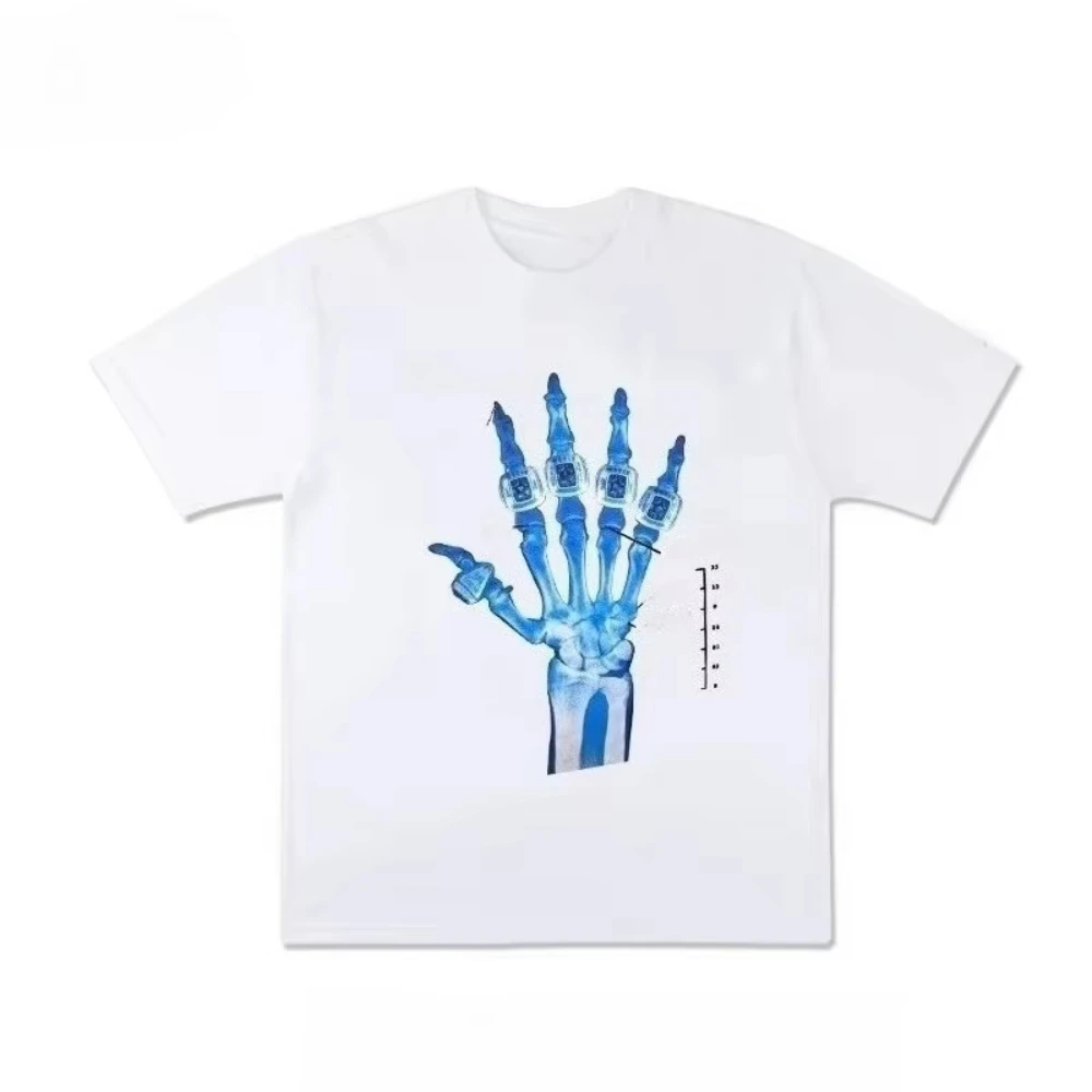 Camiseta Conmemorativa de la Lesión al Dedo de Kobe Bryant de los Lakers, Camiseta Deportiva de Manga Corta con Gráficos para Hombre