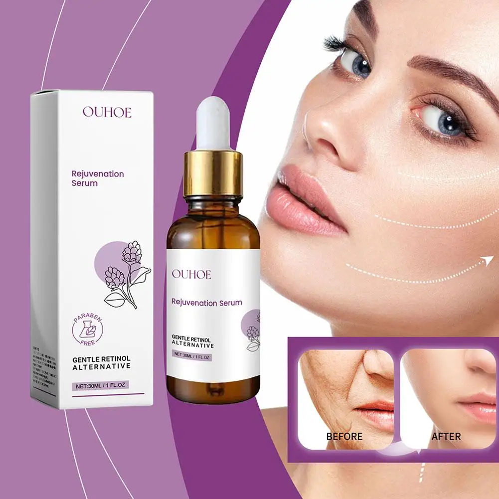 Soro facial rejuvenescedor retinol, anti-envelhecimento, essência nutritiva da pele, anti-rugas, cuidado da acne, x3w5, 30ml