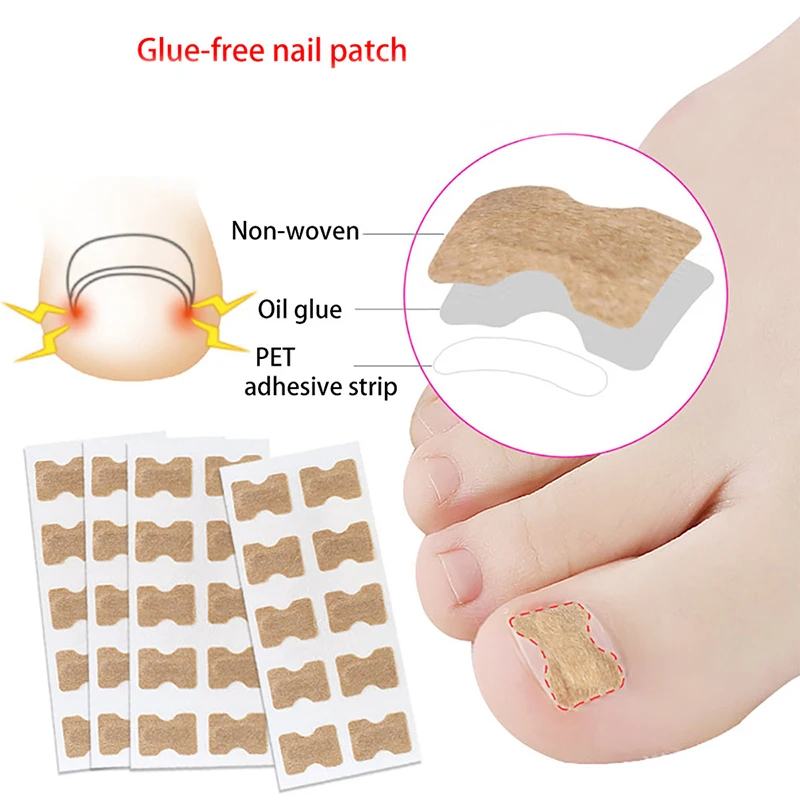 50/100Pcs Ingrown Toenail Toe Correction Stickers Nails Art Foot Patches Feet Care Paronychia Treatment Recover Pedicure Tools