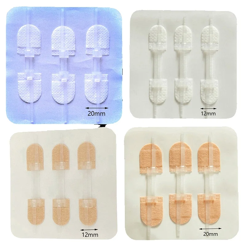 빠른 봉합 지퍼 밴드 보조 지퍼 타이 상처 클로저 패치, 지혈 패치 상처, 야외 휴대용, 3 개/세트