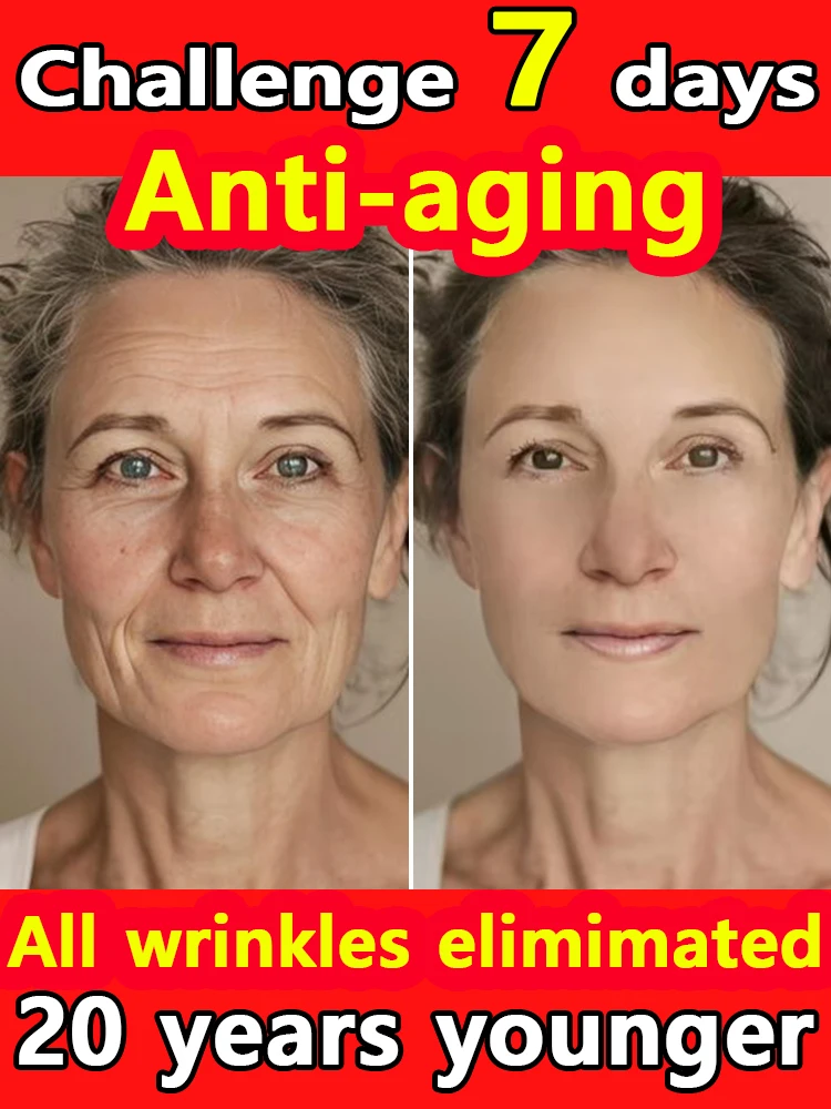 

Без морщин, 20-летний младший