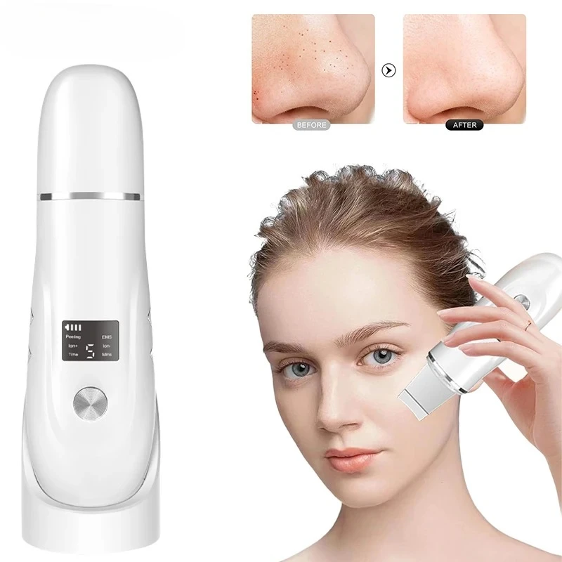 

Электрический ультразвуковой скрабер для лица, очищающее средство для глубокой очистки пор, средство для удаления акне и черных точек, пилинг-шпатель, устройство для лифтинга лица