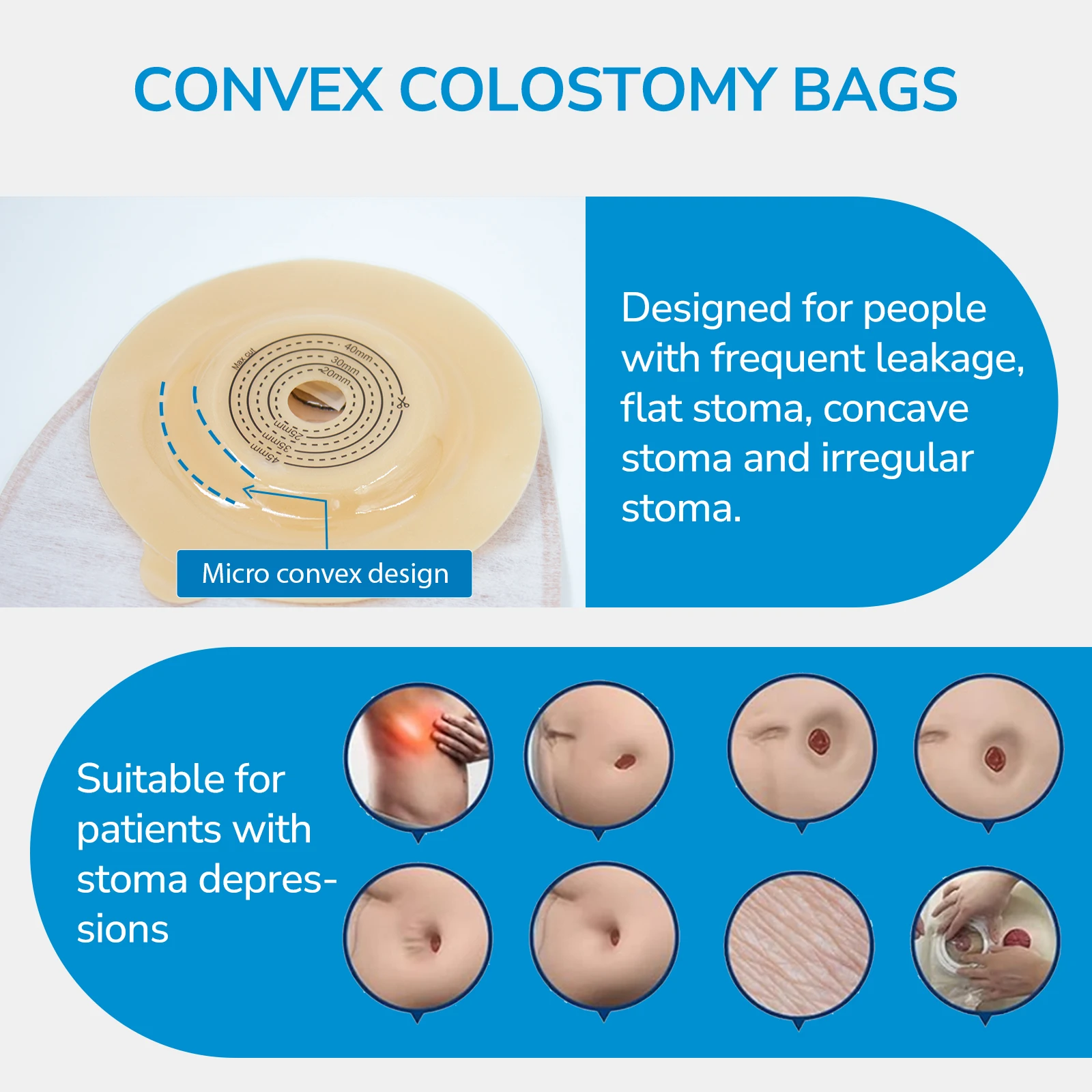 Manufacture Medical Disposable Ostomy Bag Two Pieces Colostomy Bag  Reusable Stoma Colostomy Bags Ostomy Drainable Pouch