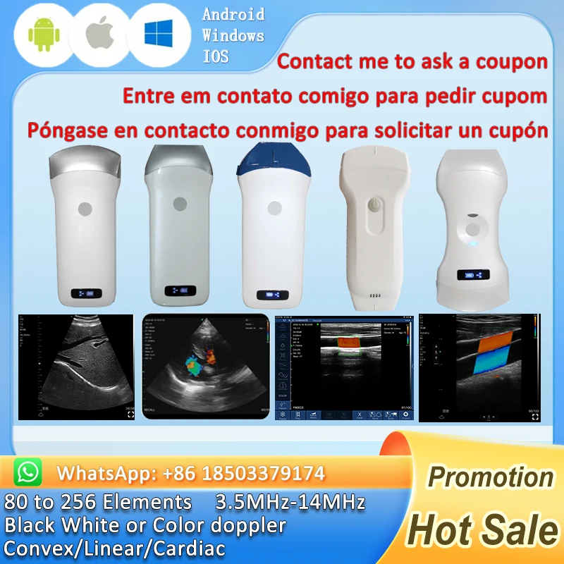 Wireless Portable Ultrasound Probe scanner WIFI Doppler wifi ultrasound scanner Machine support iOS Android Windows