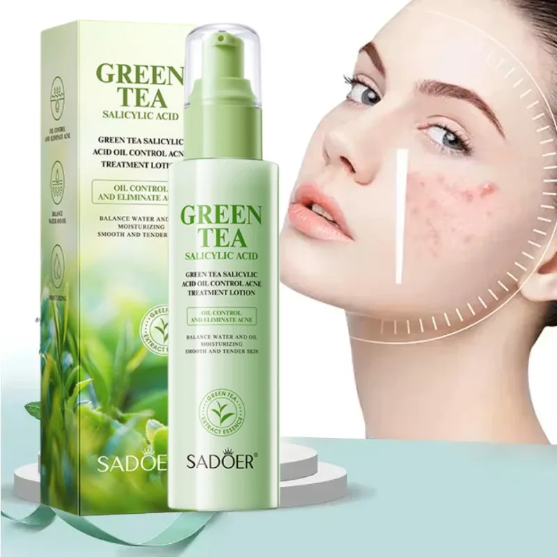 

130ml Green Tea Salicyic Acne Treatment Essence Lotion Blackhead Remover Oil Control Shrink Pores Brightening Korean Cosmetics