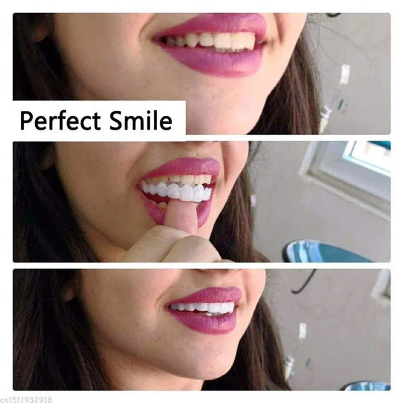 White Fake Teeth Cover Whitening Interdental Gaps Portable Braces Decorate Gaps for Teeth Enhance Aesthetic Dental Beauty Tools