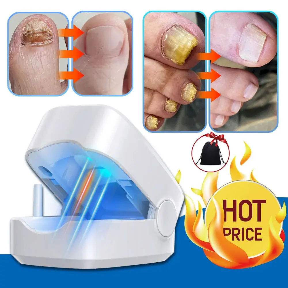 Nail Fungus Laser Treatment Device Repair Toenail Fingernail Fungus Treat Onychomycosis Therapy Cure Machine Effectively Remove