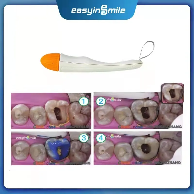 EASYINSMILE-Bandas de matriz Dental Pro, preformadas, seccionales contorneadas, Matrice, curvadas y soporte de ajuste estándar, 4,5/6mm, 10/50