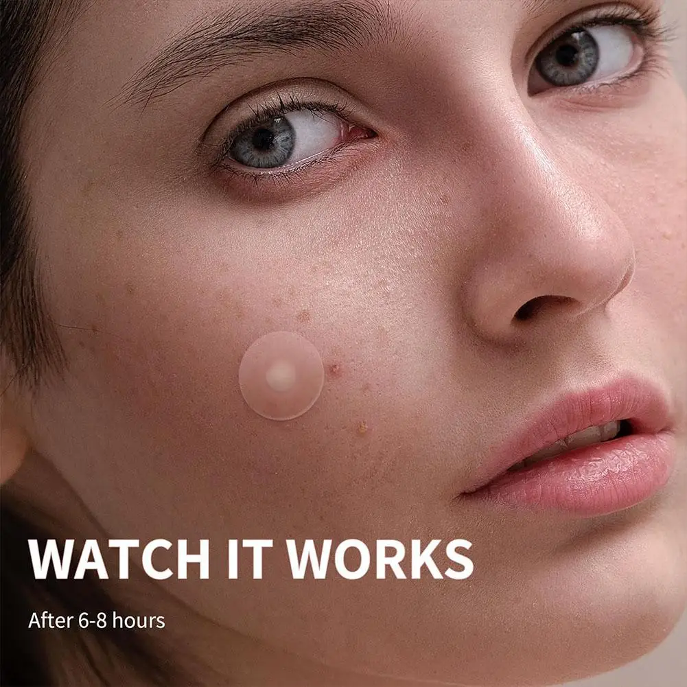 Colorful Cat Head Acne Patch Heart/Star Shape For Covering Zits Blemishes Cute Colorful Butterfly Pimple Patches Acne Stickers