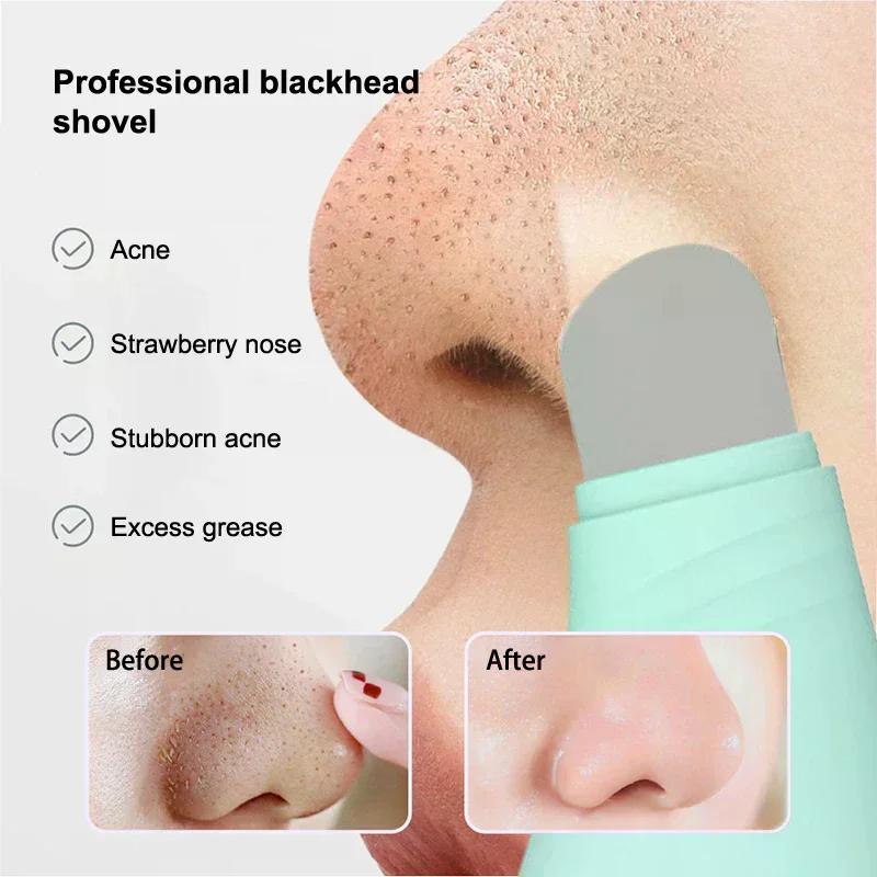 Facial Mee-eter Removal Tool Gezicht Schraper Voor Diepe Reiniging Gezicht Acne Foundation Spatel Neus Whitehead Remover Huidverzorging Tool