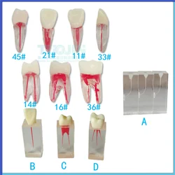 5 sztuk endodontycznych zębów Model zębów dentystycznych do badania zębów kanałowych do modeli Endo obrotowych