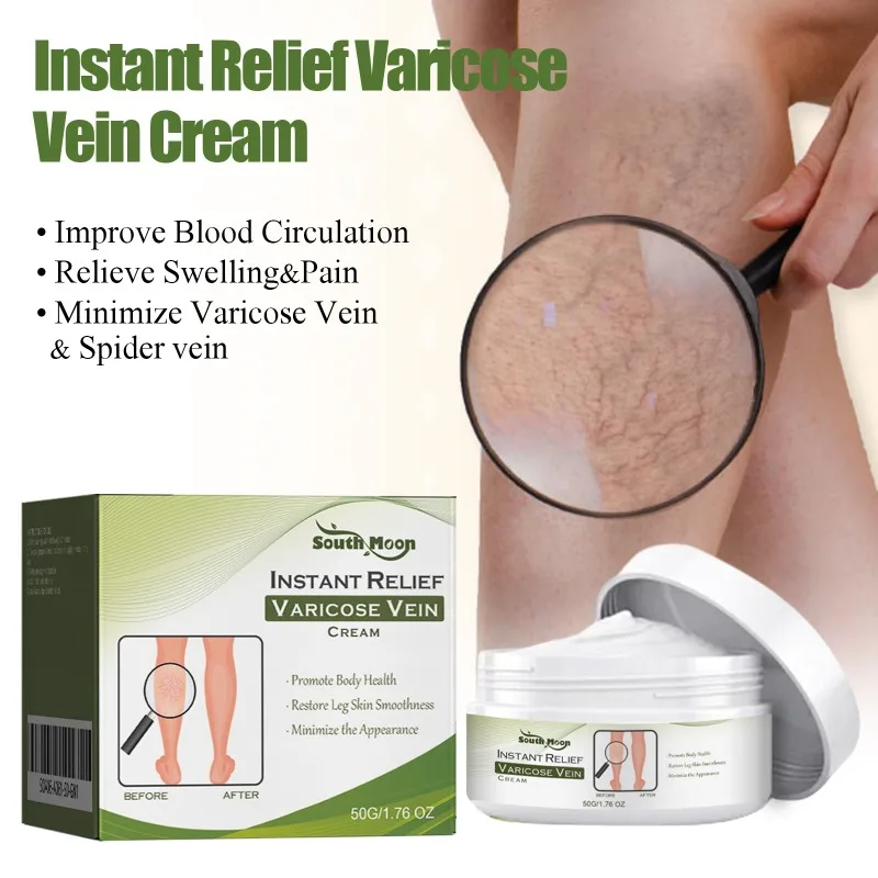 

Ointment for Varicose Veins Effective Varicose Vein Relief Cream To Relieve Leg Vasculitis Phlebitis Spider Pain Swelling Care