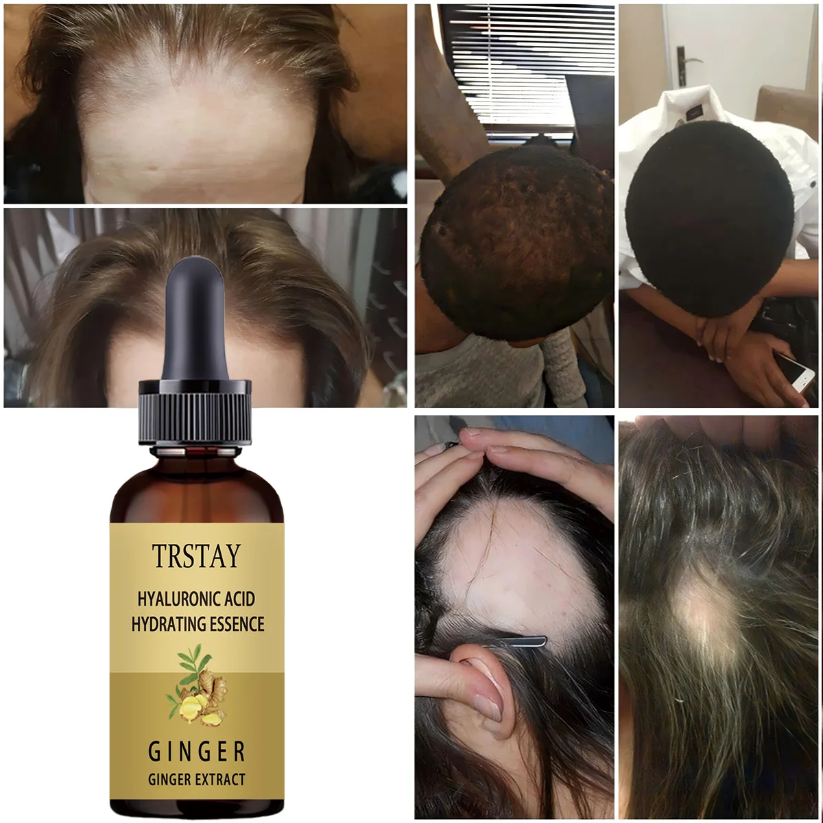 Hair Growth Serum Anti Preventing Hair Loss Alopecia Liquid Damaged Hair Repair Growing Faster - view 5
