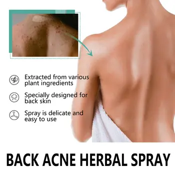 10 best sales Sırt sivilce spreyi - №2