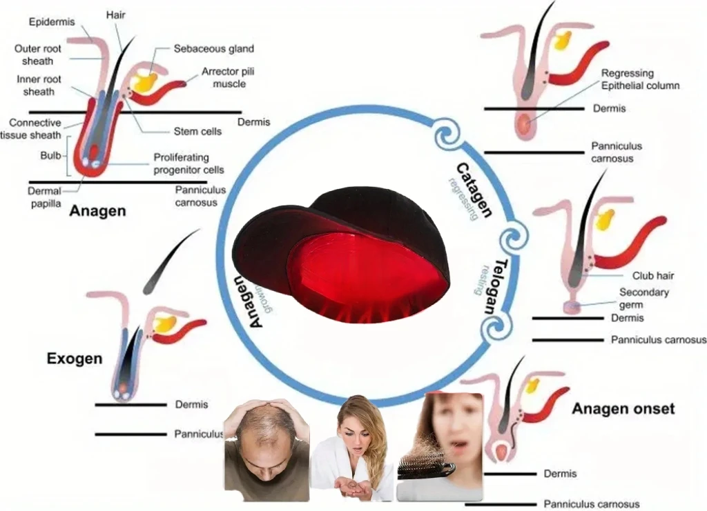 

Professional 650nm 96 Laser Hair Growth Cap HLKGO Hair Loss Treatment Device Home Use