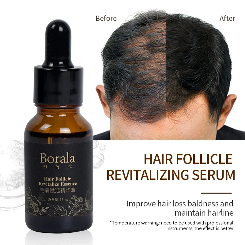 

BORALA Scalp activating essence