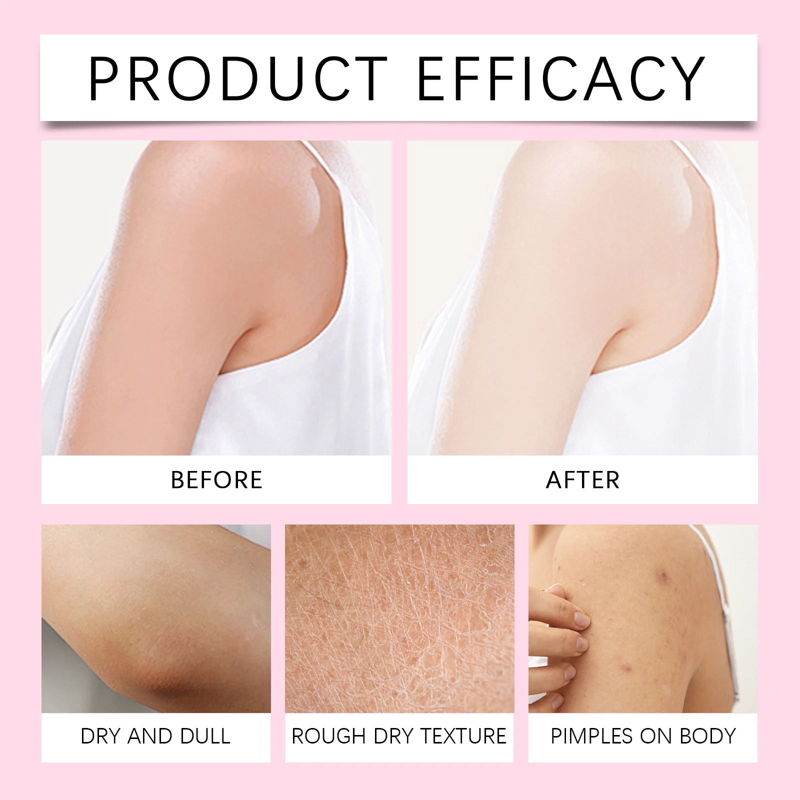Glutathione Niacinamide Body Lotion Skin Brightening Hydrate Revitalize  Even Skin Tone Face Bleaching Lightening Care white skin - AliExpress 66