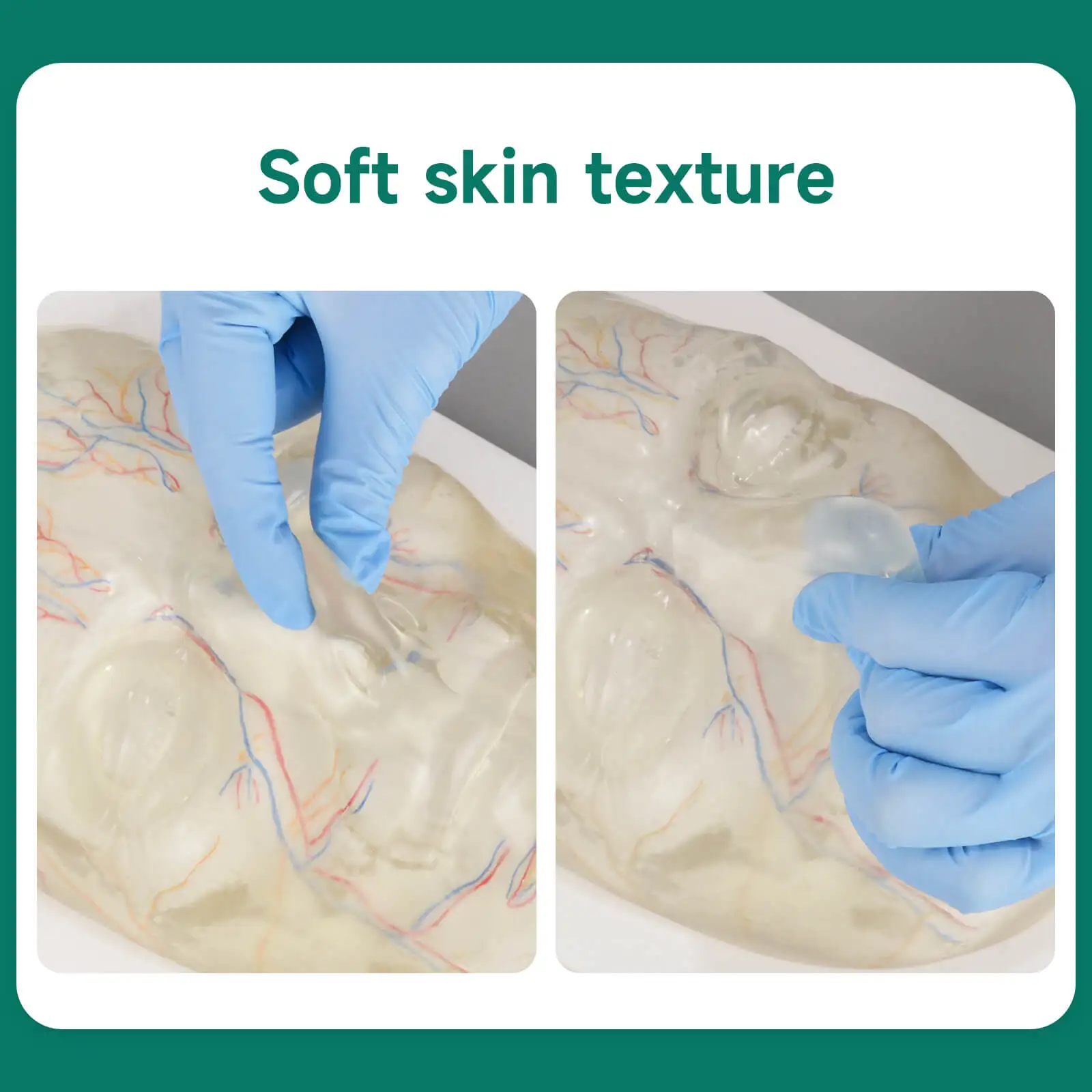 Transparent Silicone Injection Training Model With Visible Blood Vessels Dermal Filler Botox Practice for Aesthetic Teaching