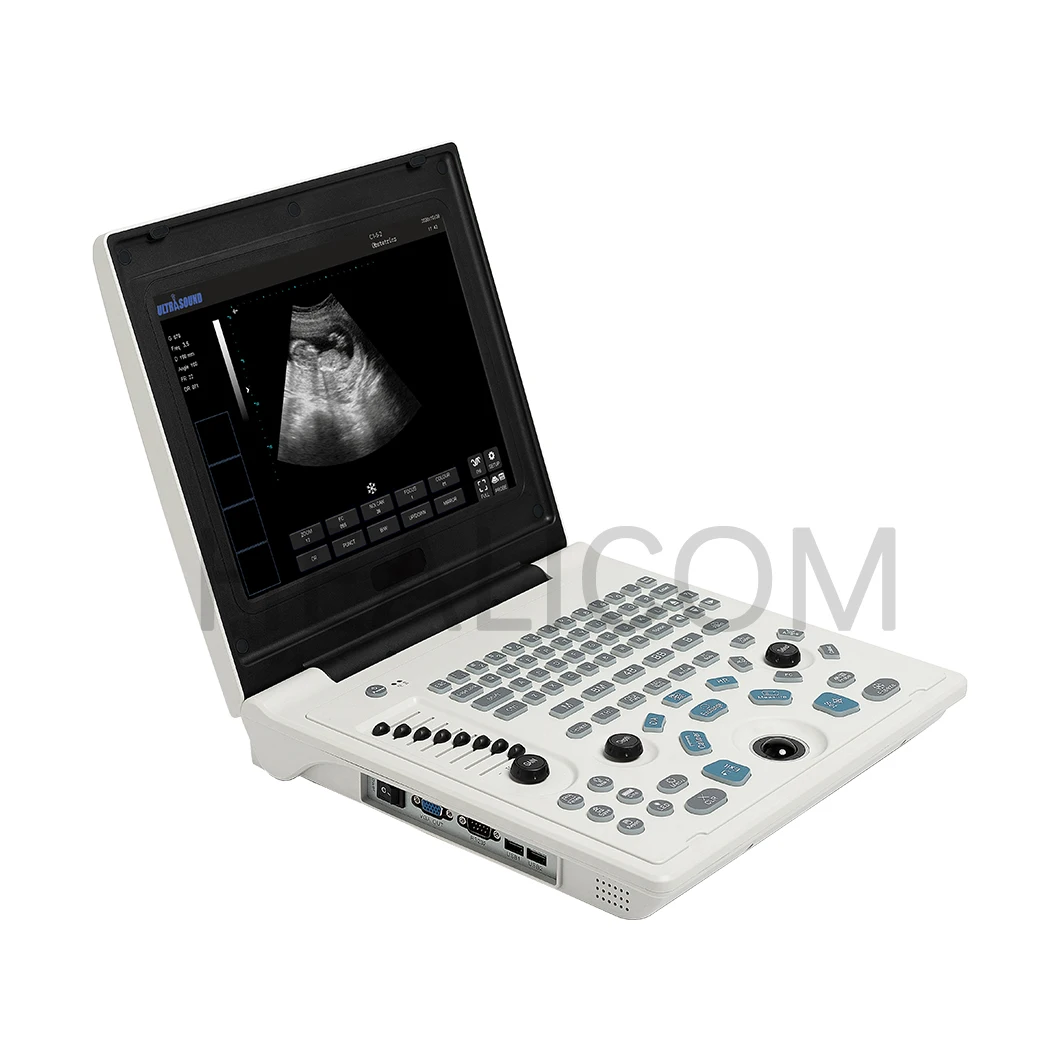 Portable PC Based B/W Full Digital Ultrasonido, Portatil LED Display Ultrasound Machine