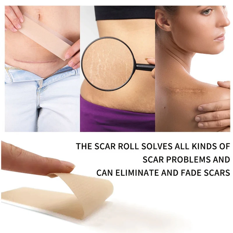 Silicone Gel Scar Remendo Remoção, Fita De Tratamento, Acne Trauma Burn Scar Cover, Seção De Reparação Da Pele, Beleza Da Orelha, 150 cm, 300 cm