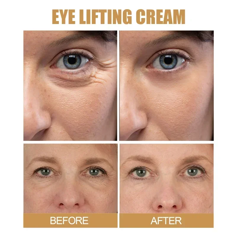 Firming Eye Cream Whiten Moisturizing repairs Dark Circles removal Eye Bags Puffiness fade fine lines Anit Aging Wrinkle Improve