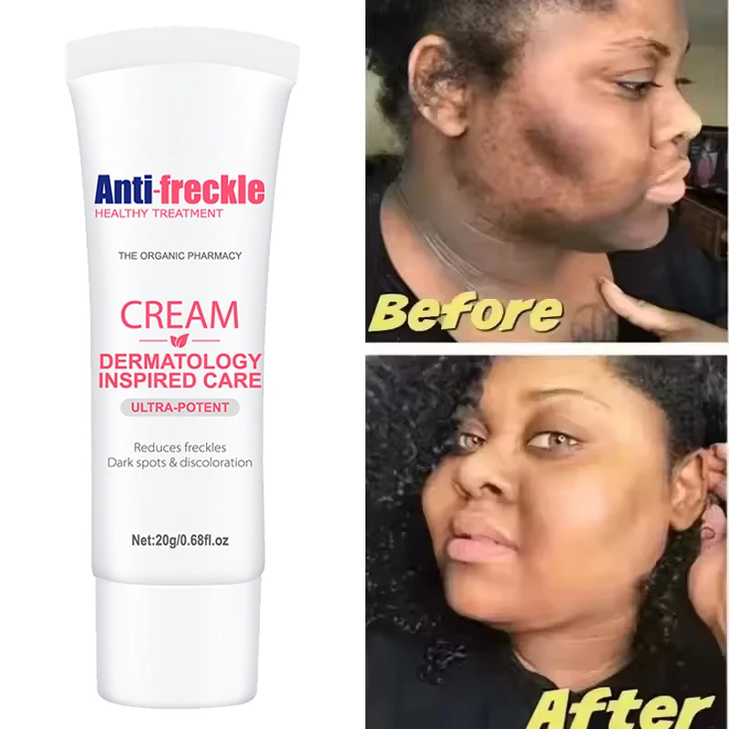 Effective Moisturizing Face Cream Nourishing Removing Skin Defects Evenly Skin Tone Gently Soothing Repairs Facial Care 20g
