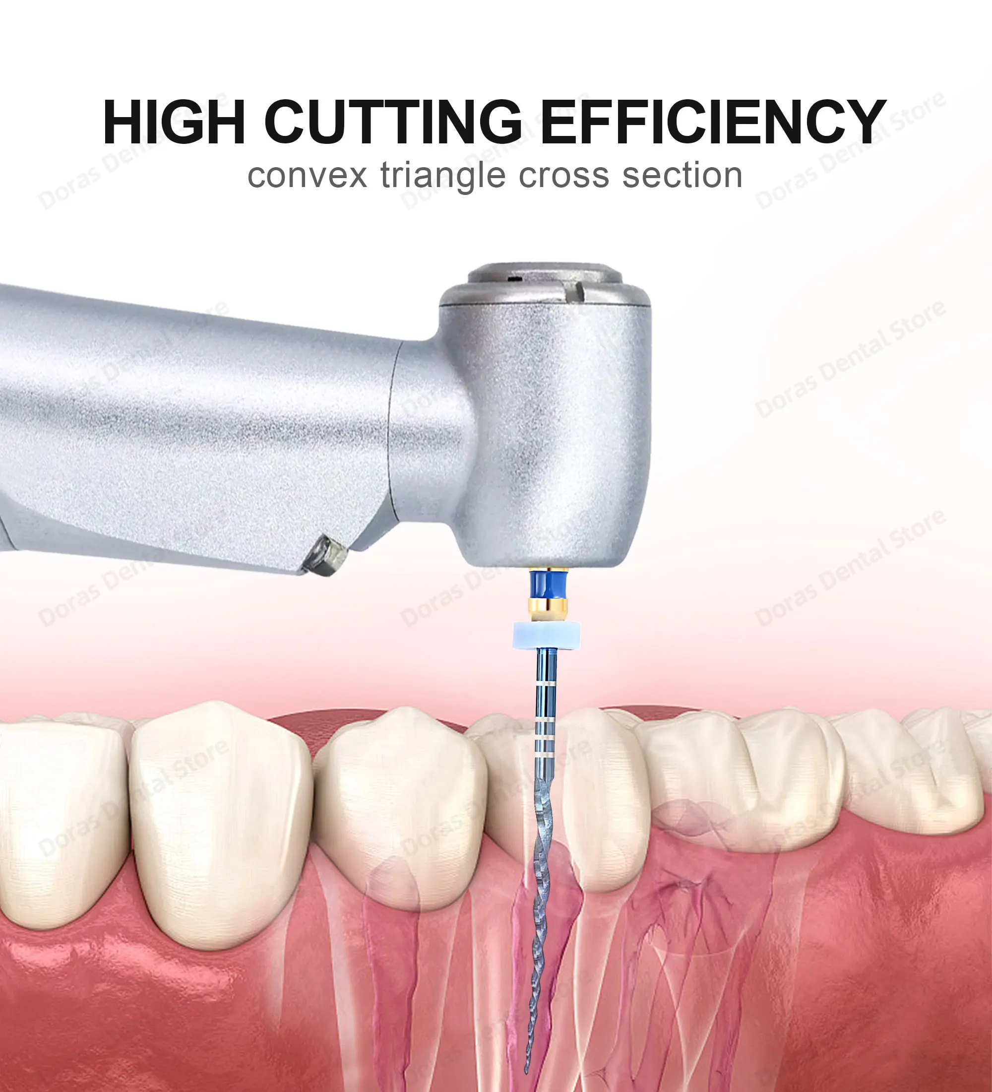 Dental Super Files Blue Rotary File Nickel Titanium Metal Root Canal File Endodontic Equipment 21/25/31mm S1/S2/F1/F2/F3/F4/F5