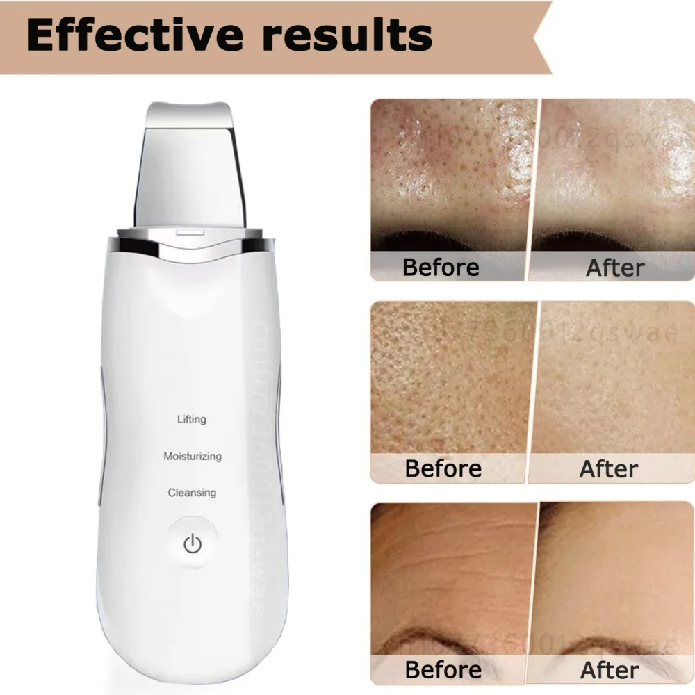 Electric Skin Scrubber Peeling Blackhead Remover Deep Face Acne Pore Cleaner Facial Spatula Shovel Cleanser Facial Cleansing