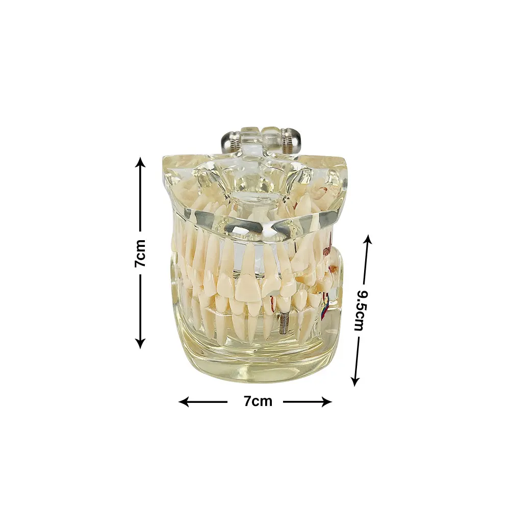 Anatomia Model dentystyczny Model nauczania zębów przezroczysty Model szczęki stomatologia patologia anatomiczny Model zębów do studiowania Typodont