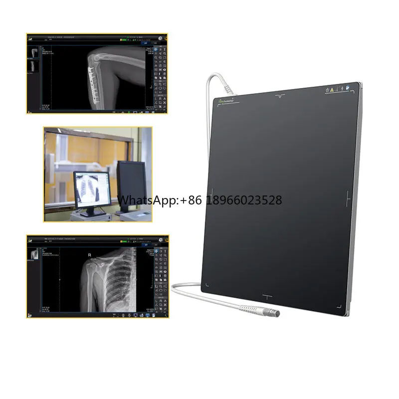 Digital flat plate detector x-ray Venu 1717X Wired digital xray dr flat panel detector