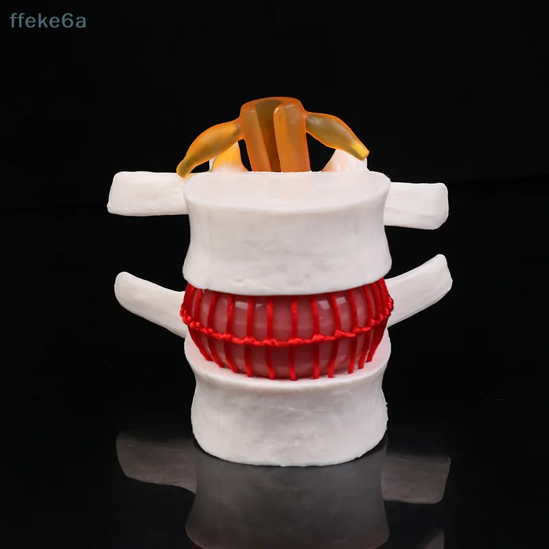 

[M] Анатомия человека, скелет позвоночника, грыжа поясничного диска, обучающая модель, череп мозга, травматические школьные принадлежности, медицинский инструмент