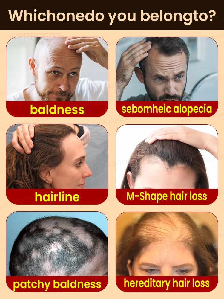 Hᴇʀʙᴀʟ ʜᴀɪʀ ɢʀᴏᴡᴛʜ ᴏɪʟ ᴘʀᴇᴠᴇɴᴛs ʜᴀɪʀ ʟᴏss ᴀɴᴅ ʜᴇʟᴘs ᴡɪᴛʜ ʀᴇᴄᴇᴅɪɴɢ ʜᴀɪʀʟɪ