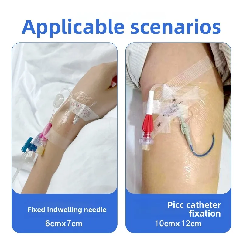 50PCS Sterile Transparent Waterproof PU Wound Dressing Medical Protector Fix PICC Venous Tube Indwelling Needle Stably
