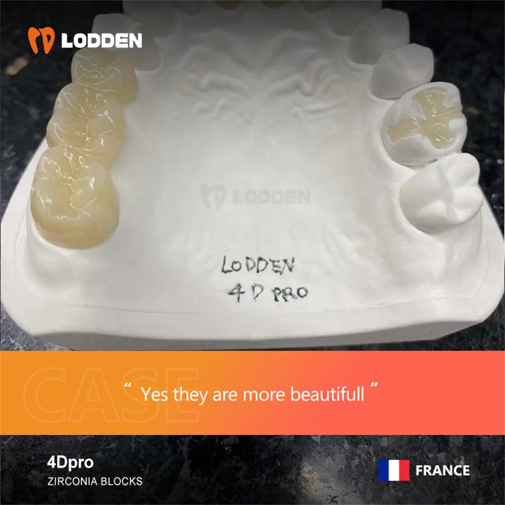 LODDEN 4D PRO Multilayer Zirconia บล็อกทันตกรรม Lab 98x22 มม. CAD CAM ระบบคงที่ Zirconia ฟื้นฟูวัสดุดัด Strength