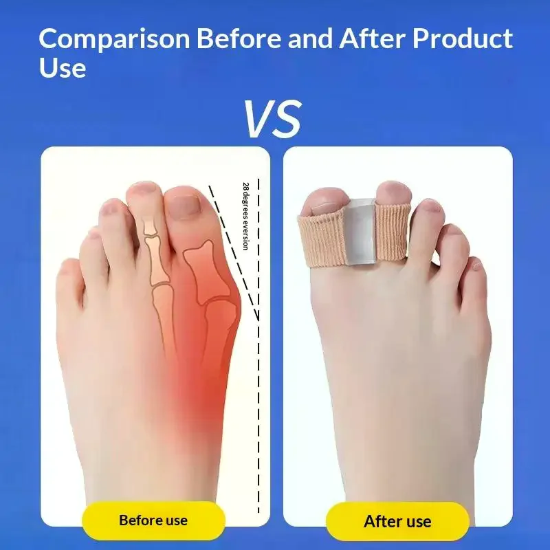 1/2PCS Silicone Toe Spreader Finger Separator Valgus Corrector Thumb Correction Straightener Foot Care Orthopedic