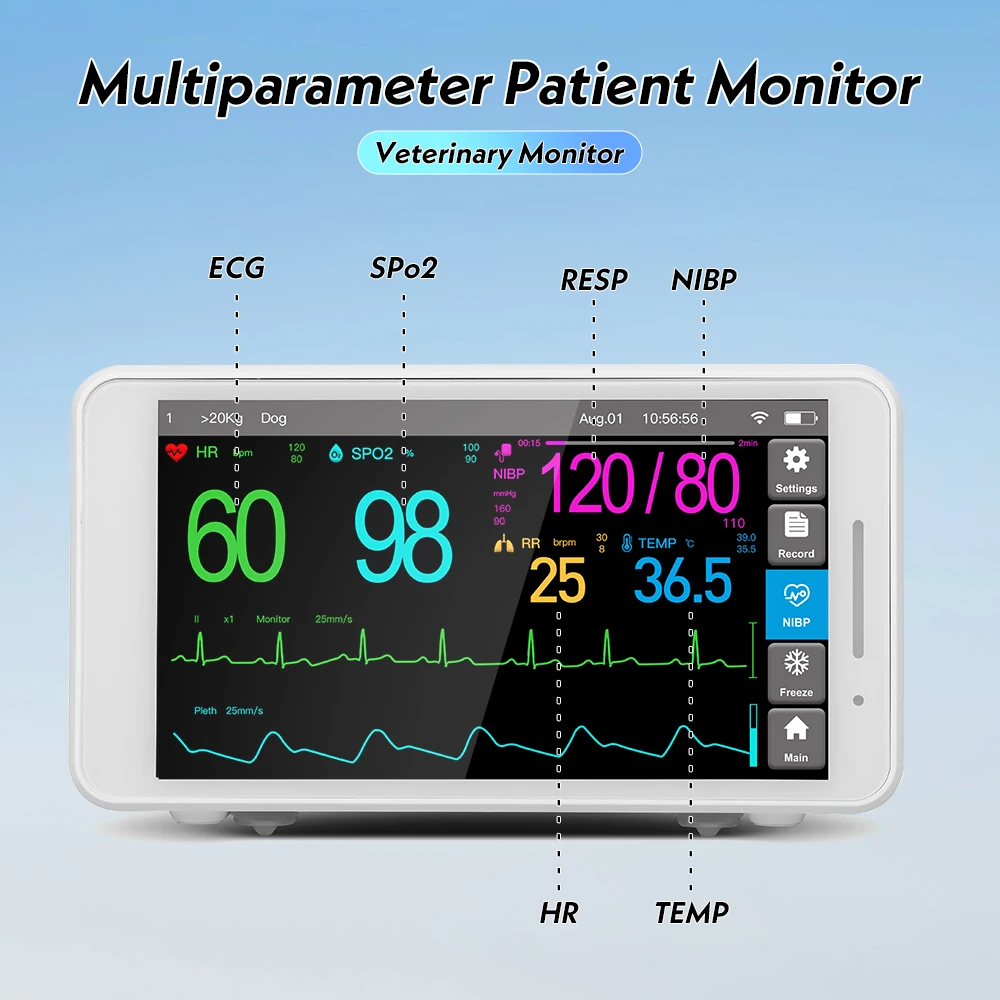 Sinohero 5,5-дюймовый монитор жизненно важных функций Портативный монитор пациента с сенсорным экраном ЭКГ, RESP, SpO2, PR, NIBP, TEMP (людина/ватеринар)