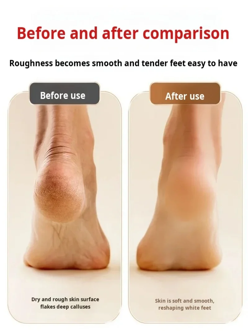 Broyeur de pieds électrique, élimination automatique des callosités, affichage numérique, plaque de pied, élimination des callosités du talon lisse